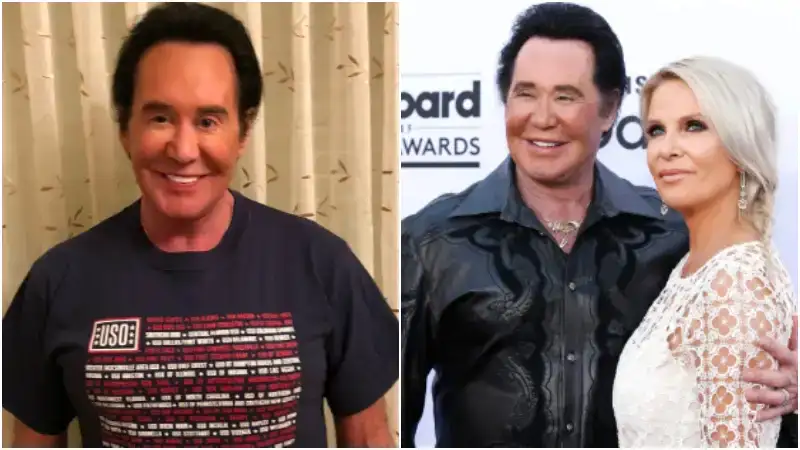 What Disease Does Wayne Newton Have? An In-Depth Look into His Health